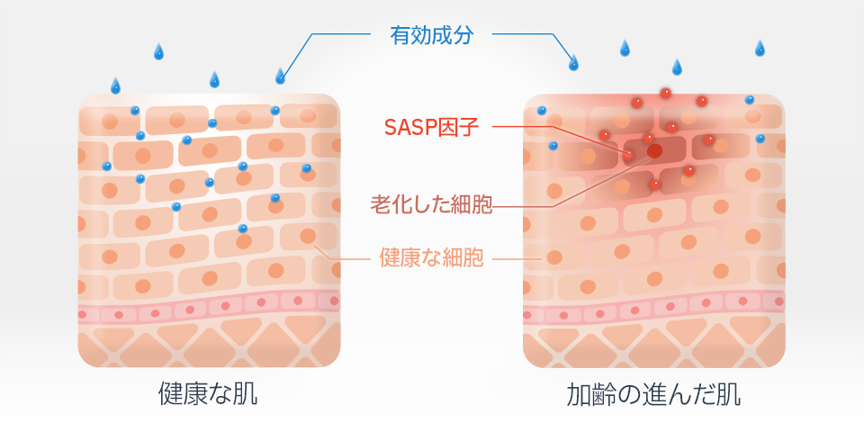 SASPによる慢性的な炎症は、肌の応答性を妨げる可能性がある