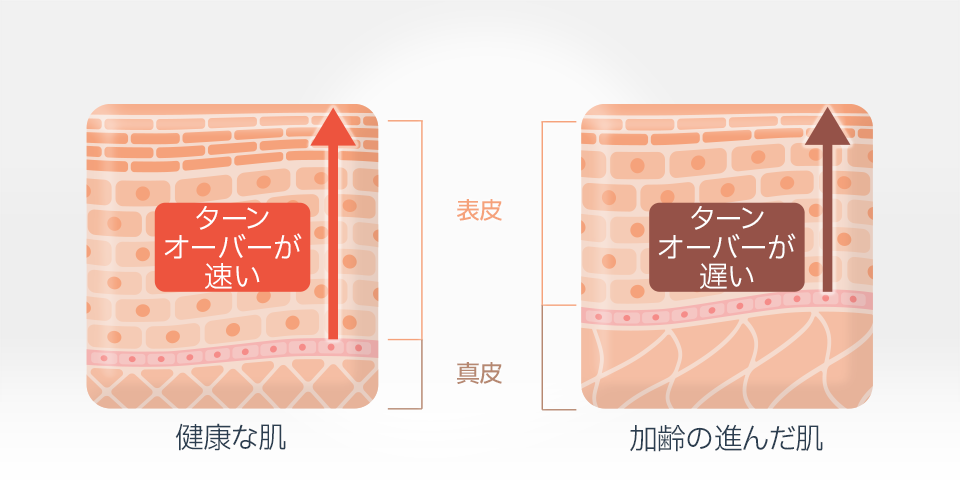 加齢によりターンオーバーは低下し、表皮と真皮の構造も変化していく